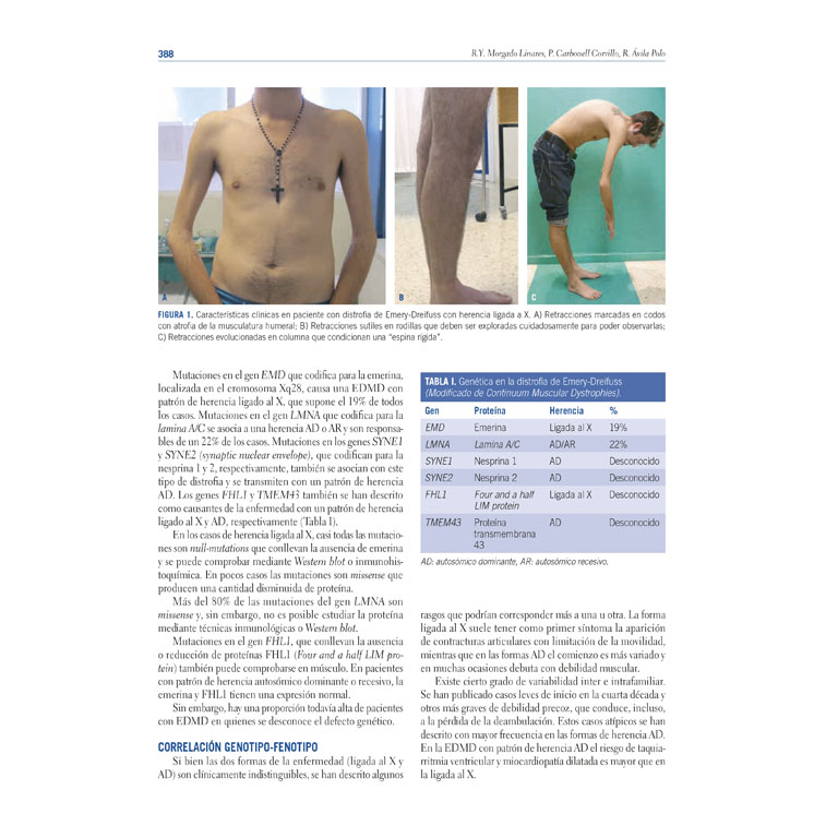 Manual De Enfermedades Neuromusculares - Ergon